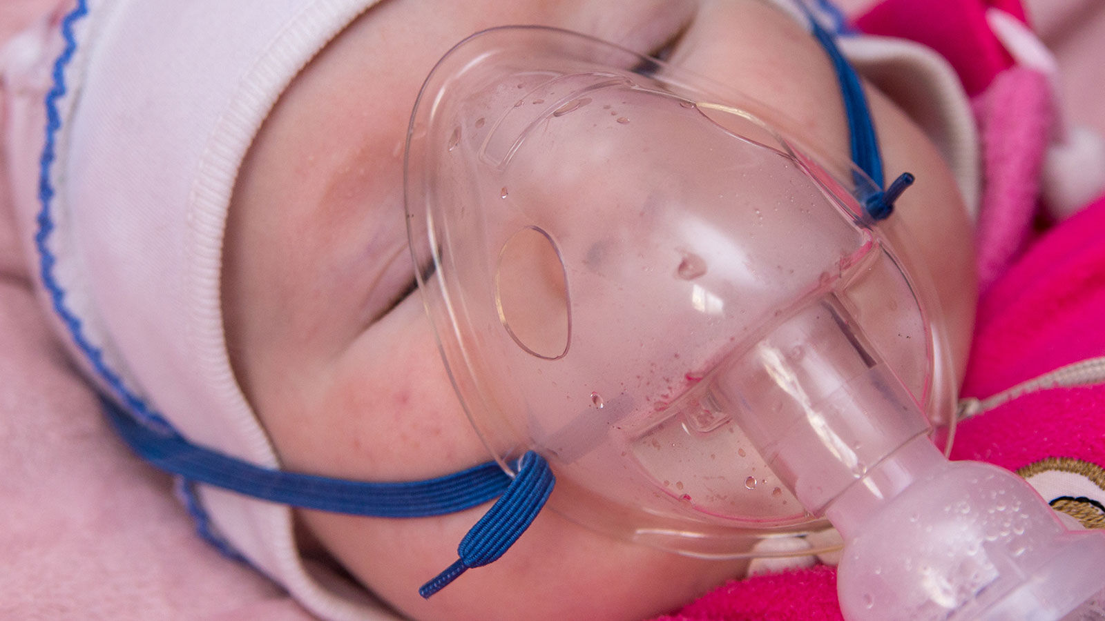 Lower respiratory tract infection in early childhood linked with higher risk of dying from respiratory disease as an adult, study finds